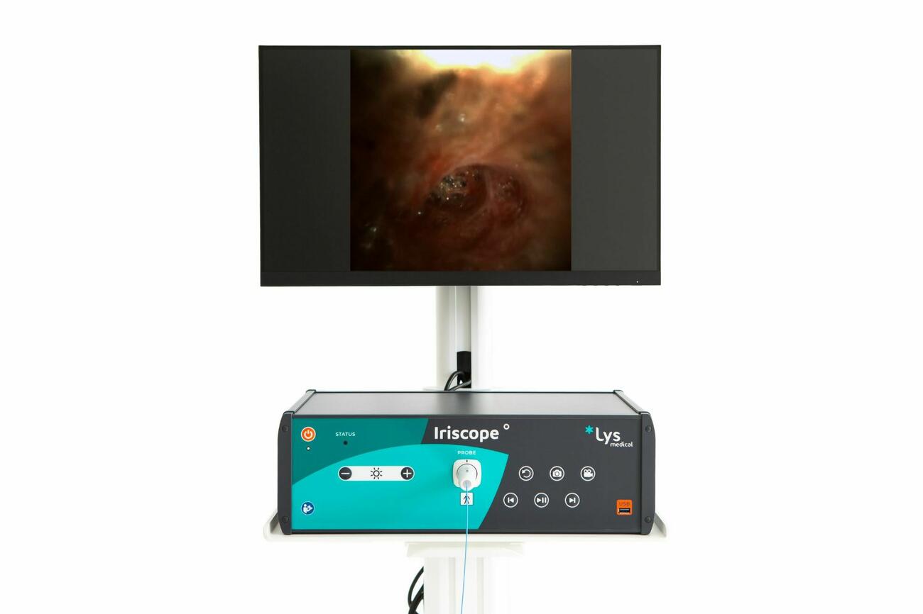 Perifere bronchoscopie100226